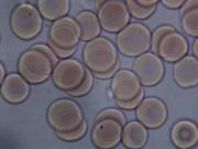 La sangre con un pH normal es fundamental para la homeostasis
